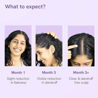 Thumbnail for BeBodywise Anti Dandruff Hair Serum