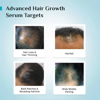 Thumbnail for Pilgrim 3% Redensyl, 4% Anagain & 5% Capilia Stem Cell Complex Advanced Hair Growth Serum Roll