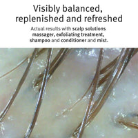 Thumbnail for Aveda Scalp Solutions Overnight Scalp Renewal Hair Serum