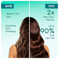Thumbnail for Careberry 100% Organic Rosemary & Jojoba Anti Dandruff Hair Oil
