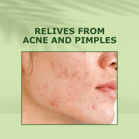 Thumbnail for Nuerma Science Tea Tree Rosemary Oil For Healthy Skin & Hair Growth