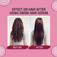 Thumbnail for Nuerma Science Onion Hair Serum with Jaborandi Oil