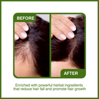 Thumbnail for She Essentials Amla Bhringraj Hair Oil For Anti Dandruff & Hair Growth