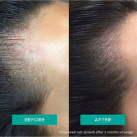 Thumbnail for Arata Intensive Hair Growth Serum