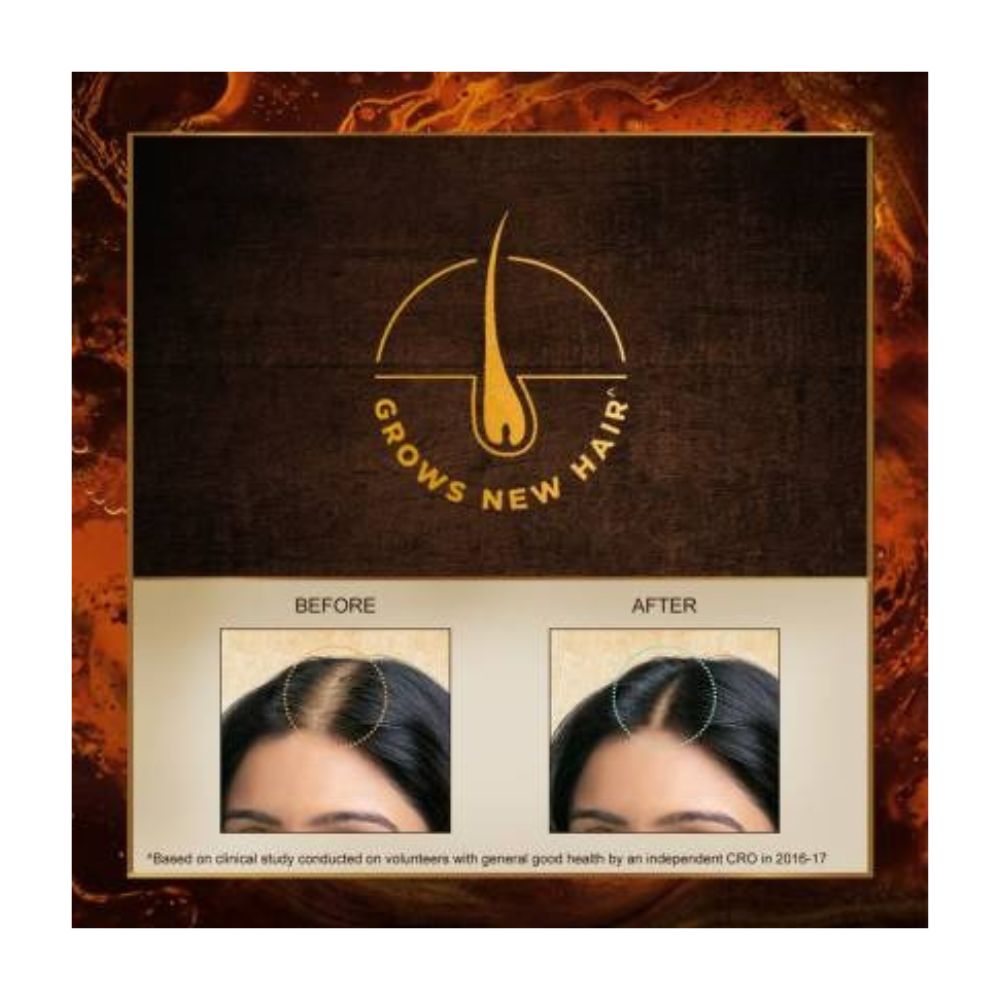 indulekha-bhringa-hair-oi