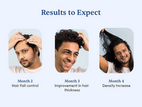 Thumbnail for Man Matters Advanced Hair Growth Rosemary Serum Roll