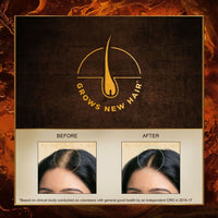 Thumbnail for Indulekha Bringha Hair Oil and Hair Fall Shampoo Combo