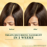 Thumbnail for Indulekha Svetakutuja Dandruff Treatment Scalp Serum