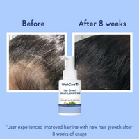 Thumbnail for WishCare Hair Growth& Anti Hairfall Range with Serum, Shampoo & Conditioner Combo