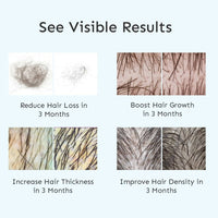Thumbnail for Arata Intensive Hair Growth Serum