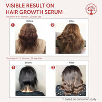 Thumbnail for Ivory Natural Serum For Growth Of Hair For New Hair Roots & Encouraging Growth Of Hair
