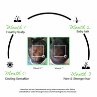 Thumbnail for Rootcos Rosemary Hair Growth Serum
