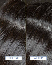 Thumbnail for Aavrani Scalp Rescue Serum