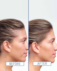 Thumbnail for Aavrani Hair Density Boosting Treatment (Serum)