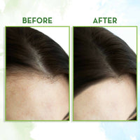 Thumbnail for Mamaearth Rosemary Hair Growth Oil with Rosemary & Methi Dana