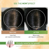 Thumbnail for Wow Life Science Rosemary With Biotin Hair Serum