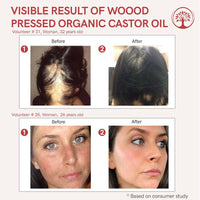 Thumbnail for Ivory Natural Wood Pressed Organic Castor Oil For Healthy Skin & Hair Wellness