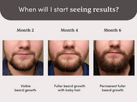 Thumbnail for Man Matters Beardmax Growth Serum, Minoxidil 5%