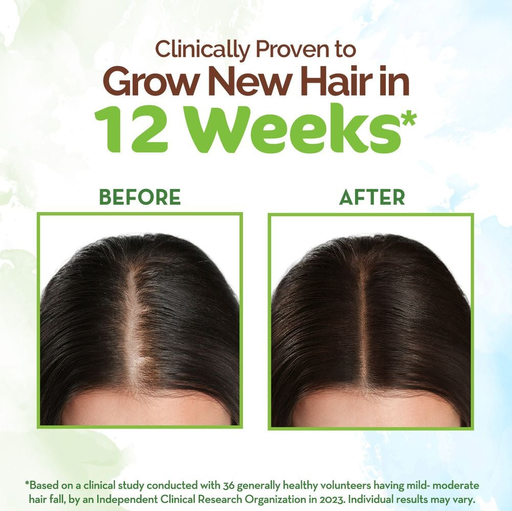 mamaearth-rosemary-hair-growth-oil-with-rosemary-&-methi-dan