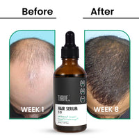 Thumbnail for ThriveCo Hair Growth Serum 2.0
