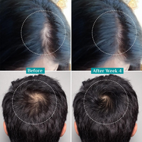 Thumbnail for Pilgrim 3% Redensyl, 4% Anagain & 5% Capilia Stem Cell Complex Advanced Hair Growth Serum Roll