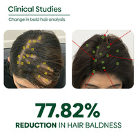 Thumbnail for Rishi Natural Adivasi Hair Oil