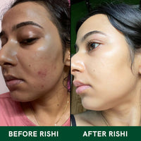 Thumbnail for Rishi Natural Skin Glow Tea