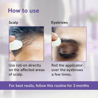Thumbnail for bebodywise-rosemary-hair-growth-serum-(roll-on