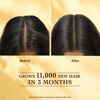 Thumbnail for Indulekha Bringha Hair Growth Treatment Scalp Serum