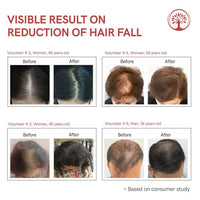 Thumbnail for Ivory Natural Hair Fall Serum For Hair Fall & Soothes Scalp, For Men & Women