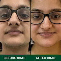Thumbnail for Rishi Natural Facial Hair Removal Tea