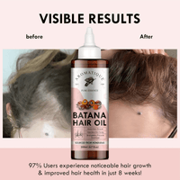Thumbnail for Aromatique Batana Oil Enriched with Rosemary, Argan, Onion, Castor Oil & More